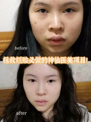 -深圳美莱医疗美容医院