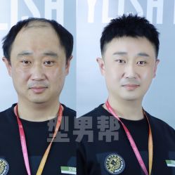 -型男帮男士假发补发·佩戴式发型