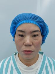 -天津健丽·去眼袋医疗美容机构