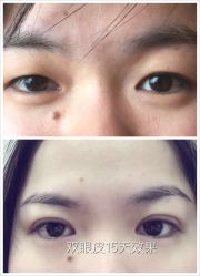 -尚玲纹绣纹眉特价店