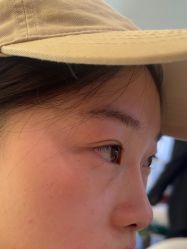 -长沙雅美医疗美容医院