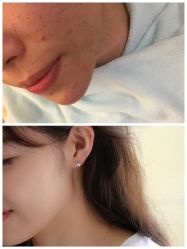 -AKI SKIN翊美芝科技美容