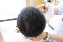 -大麦微针植发丨全国连锁