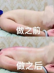 -丽减美瘦吧·减肥瘦身
