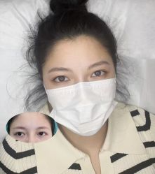 -杨益美学·野生眉半永久纹眉发际线