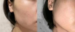 -Yestar 嘉兴艺星医疗美容医院