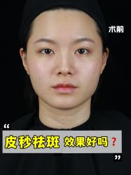 -广州美莱医疗美容医院