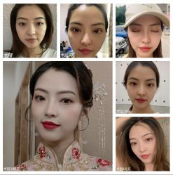点击看大图 -美莱医学美容医院