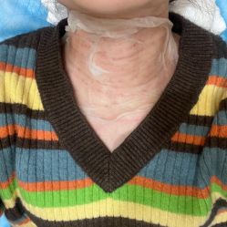 体验后-上海玫瑰医疗美容医院