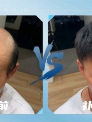-极客侠男士假发定制补发