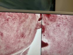 -苑苑vbeauty科技美容SPA