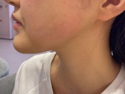 -Yestar 嘉兴艺星医疗美容医院