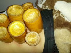 android_upload_pic-太乙盲人推拿按摩连锁(星洲店)