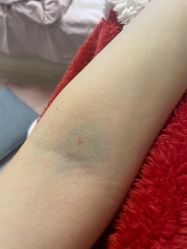 -北京大学第一医院妇产儿童医院