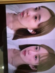 -Yestar杭州艺星医疗美容医院