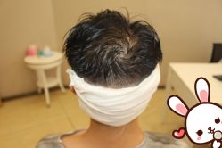 点击看大图 -大麦微针植发丨全国连锁