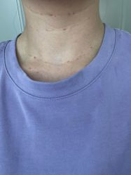 -洁铭新加坡医美