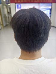 -大麦微针植发全国连锁