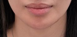点击看大图 -Yestar 嘉兴艺星医疗美容医院