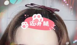 -大麦微针植发全国连锁