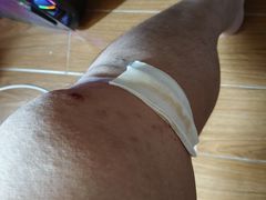 -南方医科大学深圳医院