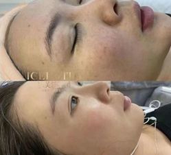 -冰芙洁问题性皮肤美甲美睫