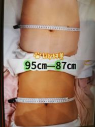 -Lily纤美·科技减脂中心