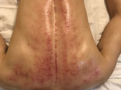 -安琪盲人按摩调理草本熏蒸馆(风和日丽店)