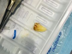-深圳乐孚正强口腔诊所(宝体店)