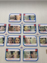 -悟空祛痘·诺奖技术专业店