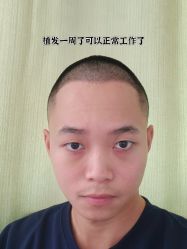 -雍禾植发全国连锁