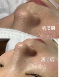 点击看大图 -DMK酶疗中心·BeautyYoung舒妍科技美肤
