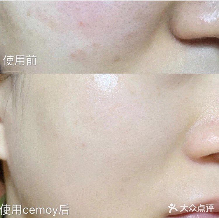 半透明质地，不粘腻，吸收快