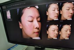 -慕颜医疗美容·皮肤微整 抗衰