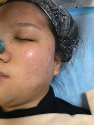 -长沙雅美医疗美容医院