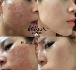 -黎蓓露·徒手骨雕蛋白抗衰·调肤管理