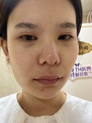 体验前-紫洁俪方（北京）医疗美容