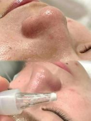 -SKIN79皮肤管理中心