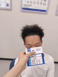 -大麦微针植发全国连锁