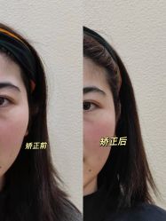 -颜和骨正·明哲式骨相美学整骨