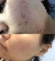 -康美贞·痘肌养护管理中心