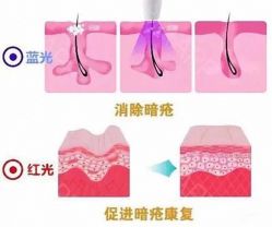 点击看大图 -广州美莱医疗美容医院
