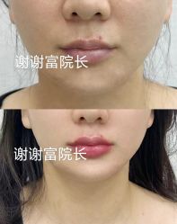 -深圳艺星医疗美容医院