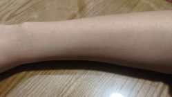 体验后-哈尔滨瑞丽医疗美容医院