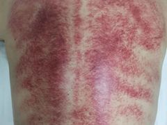 -鸿福推拿养生馆(砬子山店)