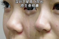 -深圳艺星医疗美容医院