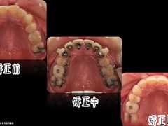 -团圆口腔·种植中心(锦江院区)