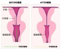 -邢台妇产医院