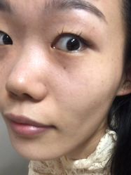 点击看大图 体验后-木锦-科技美肤