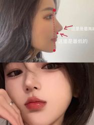 -成都西区医院整形美容